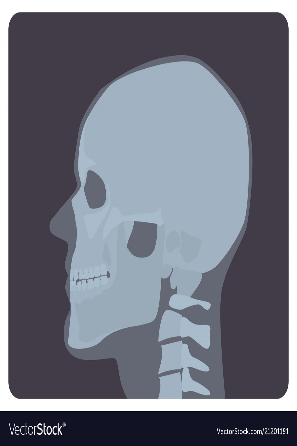 Lateral radiograph of skull x-ray picture Vector Image